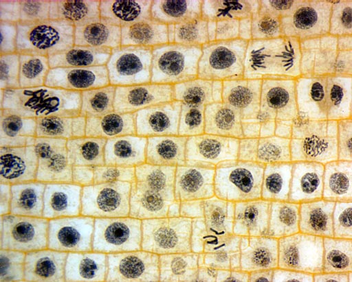 onion root tip section 60x brightfield stacked